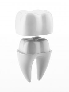 Best Tulsa Dentist