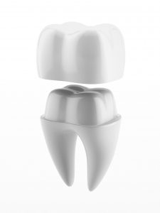 Tulsa Dental Crown Care