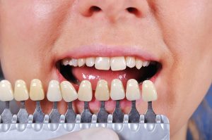 Best Tulsa Dental Care