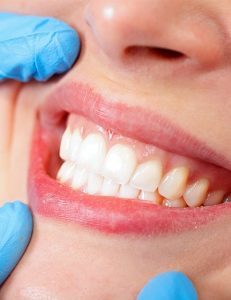 tulsa dental bridges