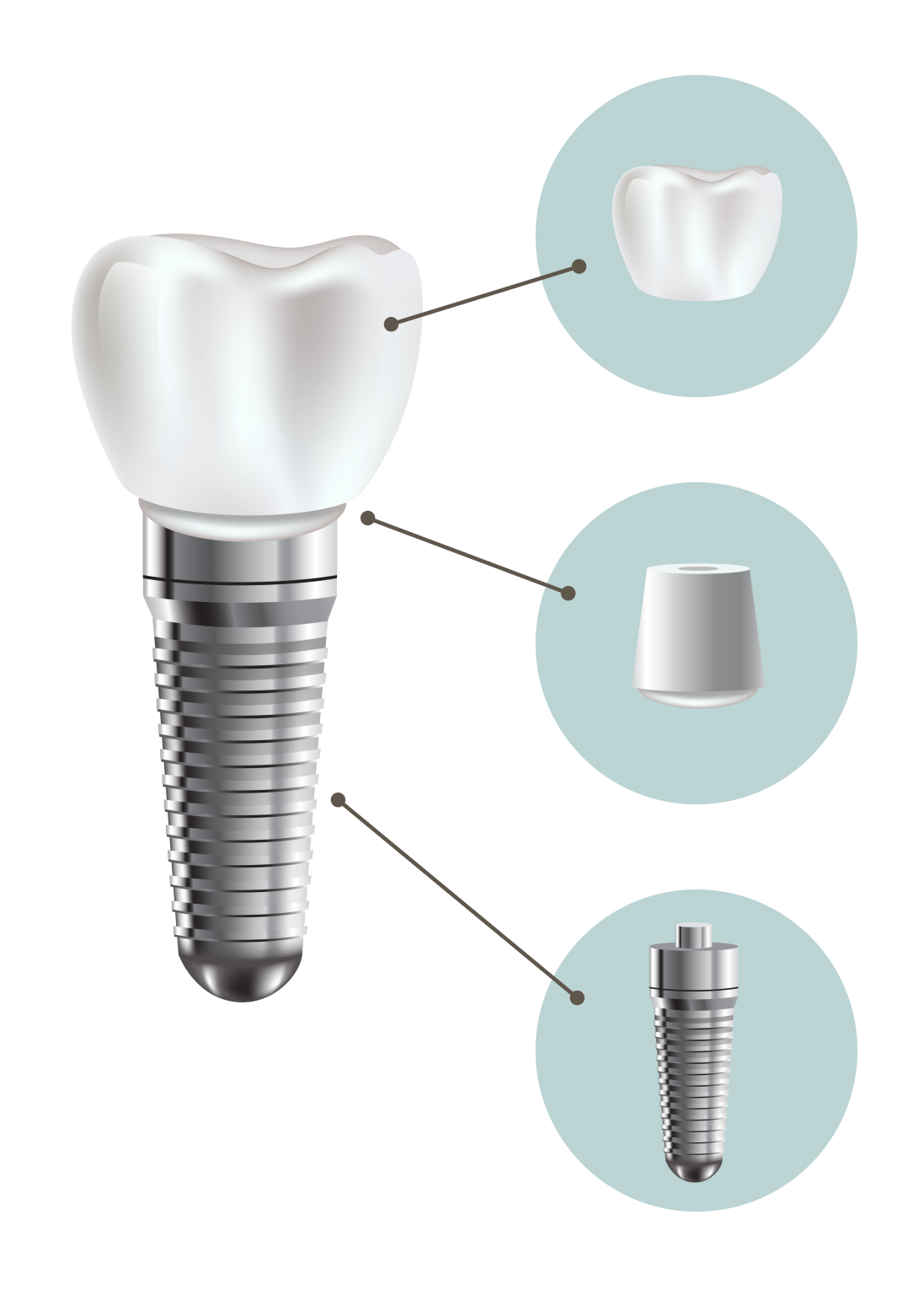 South Tulsa Dental Implants Magnolia Family Dental Care Tulsa Dentist Tulsa, OK