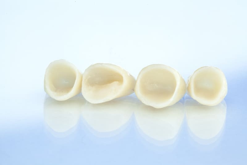 Dental Crowns Frequently Asked Questions