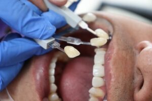 Dental Crown Emergency