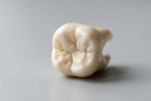 Close-up of a single molar tooth lying on a gray surface, showing its grooves and subtle cracks in a pale ivory color.