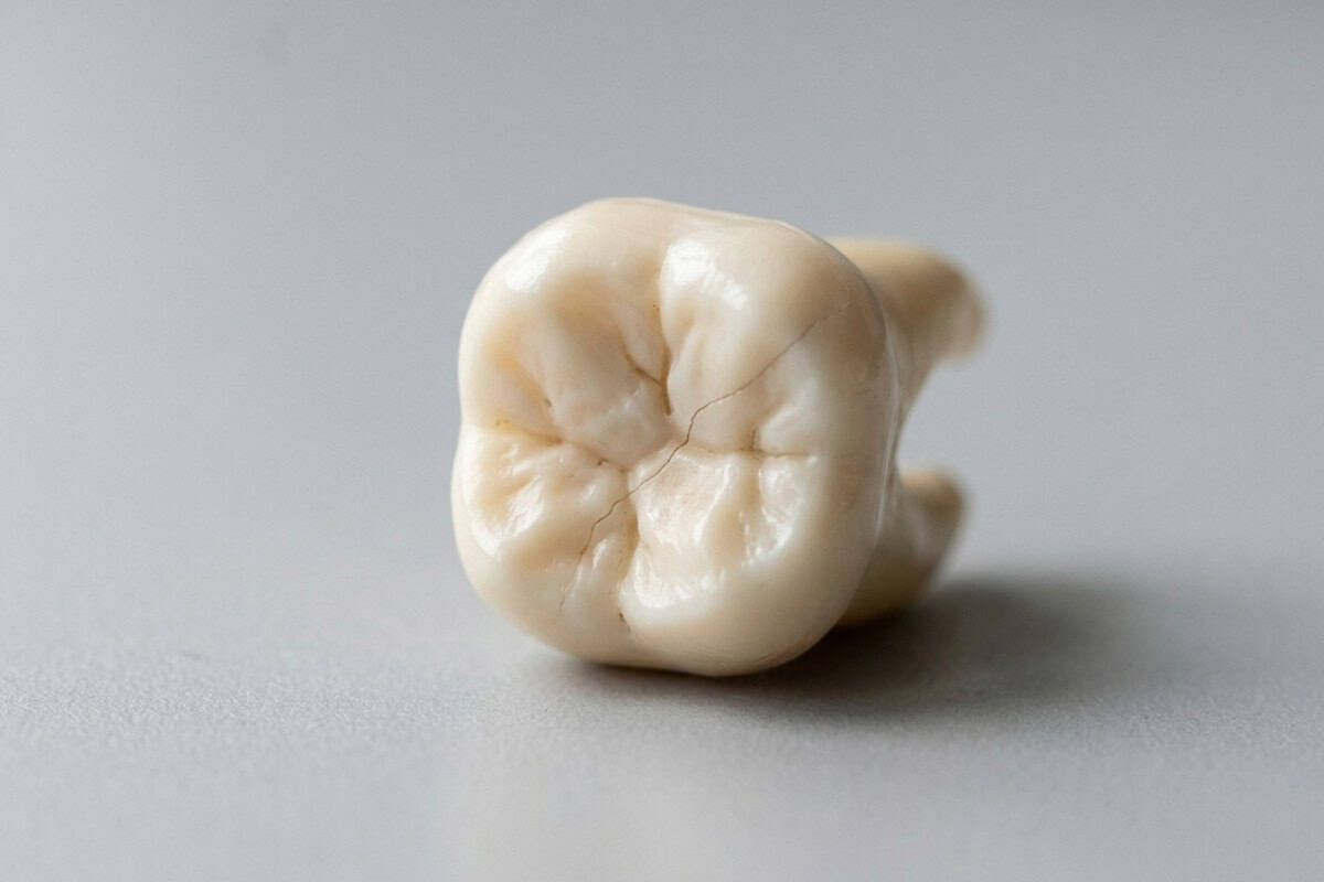 Close-up of a single molar tooth lying on a gray surface, showing its grooves and subtle cracks in a pale ivory color.
