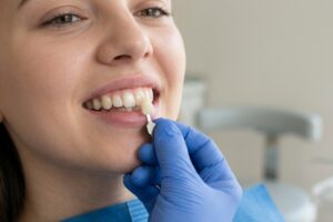 Close-up of a dental clinician placing a veneer on a patient’s upper front tooth while smiling and holding the tooth with a tool.